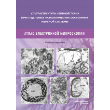 Ультраструктура нервной ткани при отдельных патологических состояниях нервной системы. Атлас  электронной микроскопии.